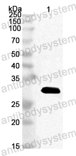 Anti-Staphylococcus aureus entE/SEE Polyclonal Antibody