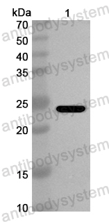 Anti-European house dust mite DERP7/Der p 7 Polyclonal Antibody