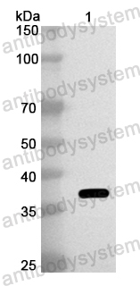 Anti-European house dust mite Der p 1/DERP1 Polyclonal Antibody