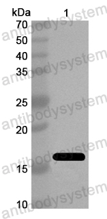 Anti-European house dust mite Der p 2/DERP2 Polyclonal Antibody