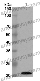 Anti-Plasmodium relictum MSP1 Polyclonal Antibody