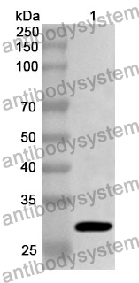 Anti-YTHDC/101267743 Polyclonal Antibody