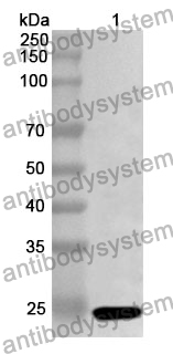 Anti-YTHDC/LOC101245931 Polyclonal Antibody