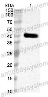 Anti-Common timothy Phl p 6/PHLPVI Polyclonal Antibody