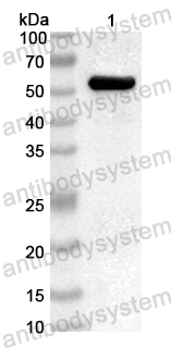 Anti-Common timothy PHLPIV/Phl p 4 Polyclonal Antibody