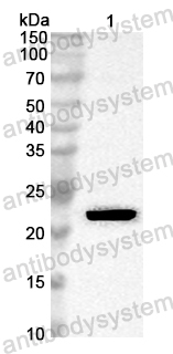 Anti-Pistachio Allergen Pis v 2/11S globulin Polyclonal Antibody