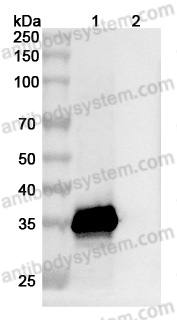 Anti-CH1&CH2/Allergen Fel d I-A&B Antibody (SAA0615)