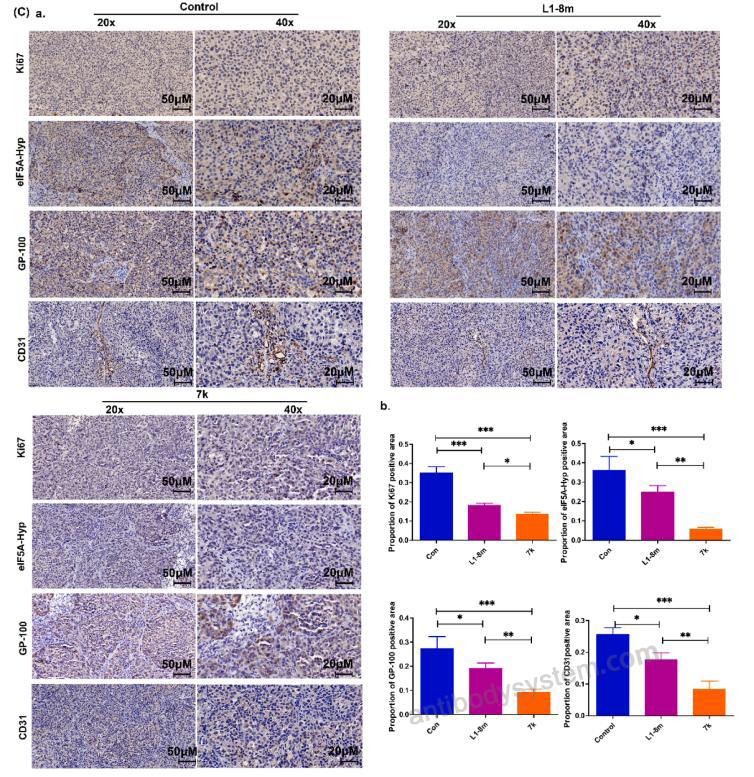 Immunohistochemistry for Anti-Hypusine antibody (Hpu24) ?>