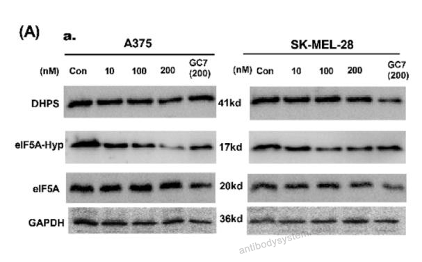 Western Blot for Anti-Hypusine antibody (Hpu24) ?>