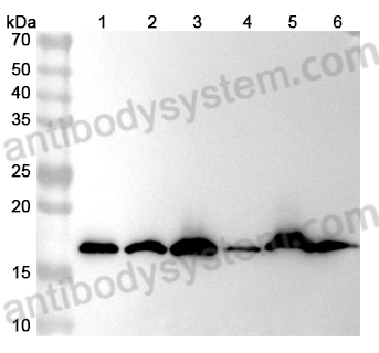 Anti-Hypusine Antibody (Hpu98.61)