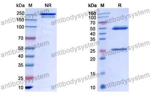 Anti-DNA Antibody (202.61)