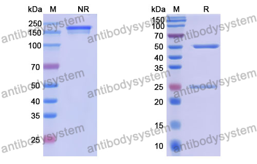 Anti-DNA Antibody (17s.130)