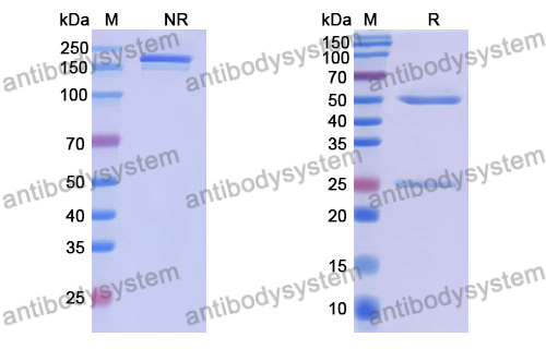 Anti-DNA Antibody (17s.93g)