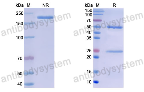 Anti-DNA Antibody (17s.145)