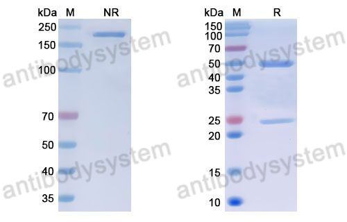 Anti-DNA Antibody (17s.23)