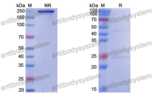 Anti-DNA Antibody (17p.80)