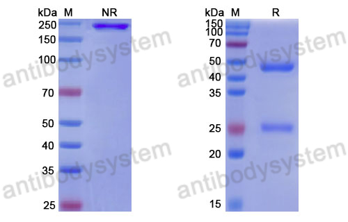 Anti-DNA Antibody (17s.21)