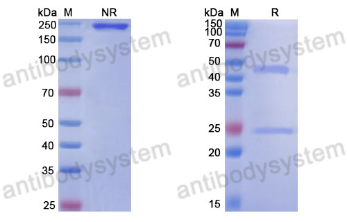 Anti-DNA Antibody (17s.13)