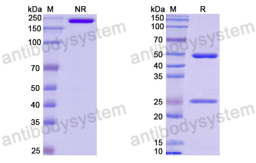 Anti-DNA Antibody (III-2R)