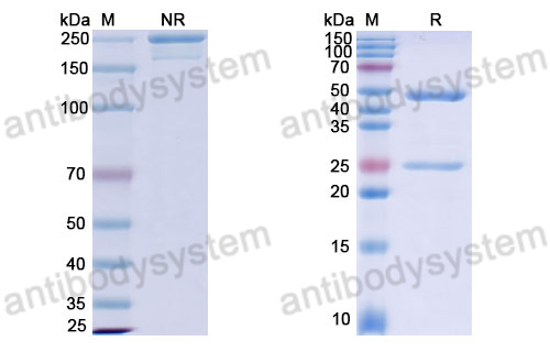 Anti-DNA Antibody (1E81#)