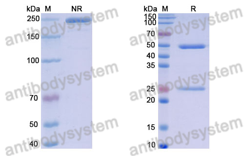 Anti-DNA Antibody (BV17-31)