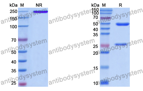 Anti-DNA Antibody (DNA2)