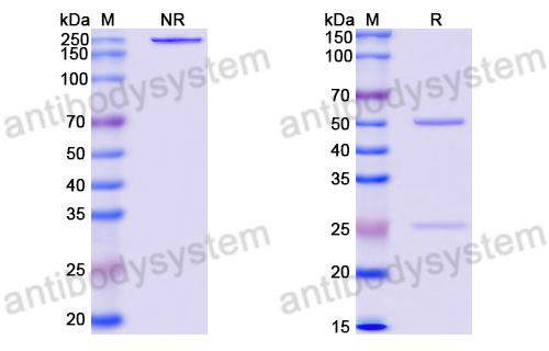 Anti-DNA Antibody (AD4-18)