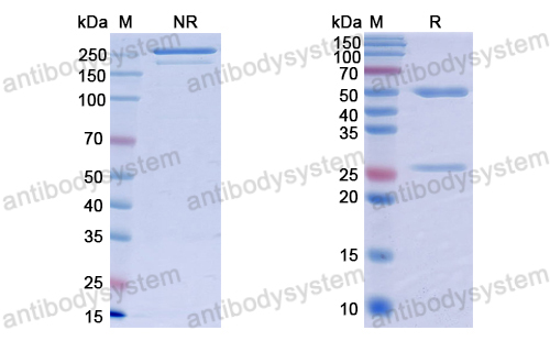 Anti-dsDNA Antibody (3E10#)