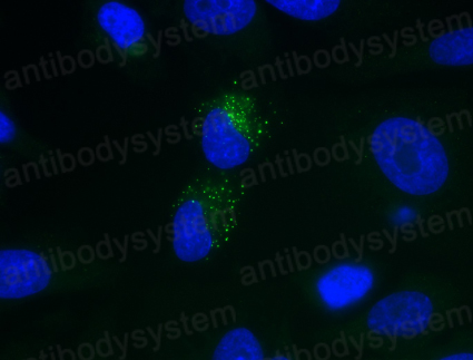 Immunofluorescence for Anti-dsRNA Antibody (J2) ?>