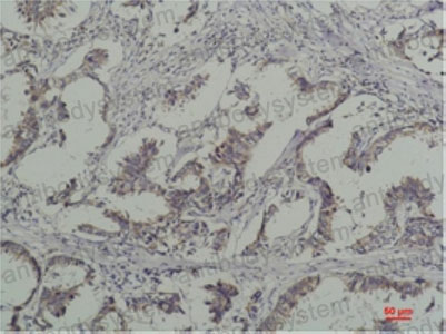 Anti-Phospho-Tyrosine Antibody (R3Z20)