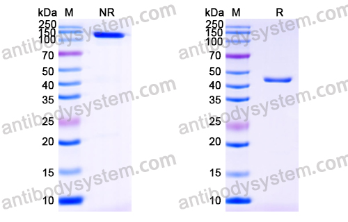 Anti-Cortisol Antibody (SAA1437)