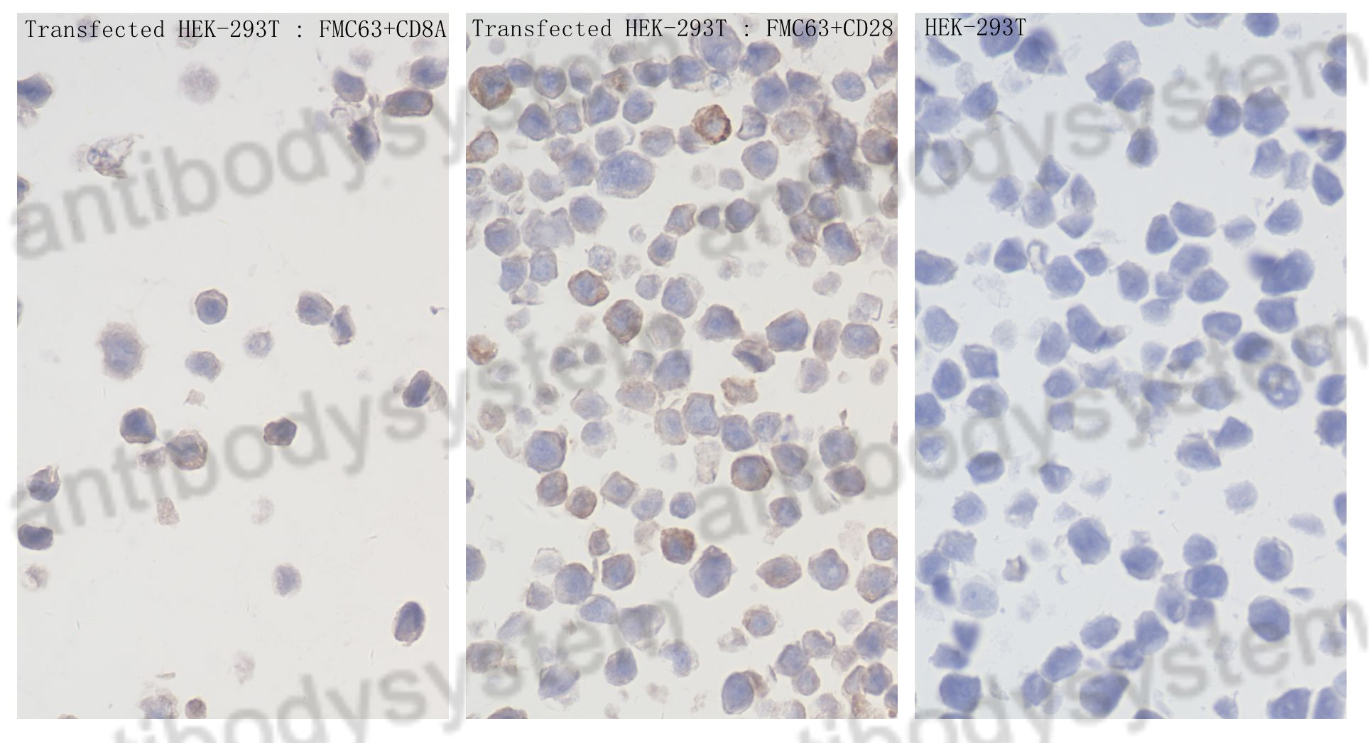 Anti-GGGGS Linker Antibody (R4E06)