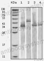 Anti-Trx Tag Antibody (R4D81)