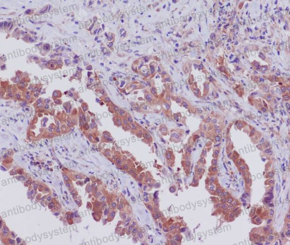 Anti-SGK1 Antibody (R1C59)