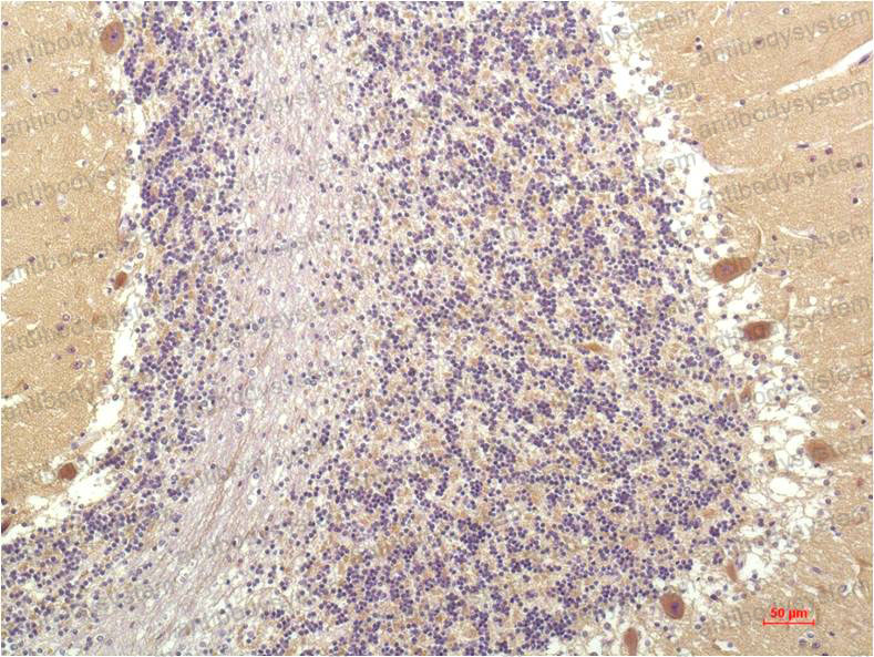 Anti-SGK1 Antibody (R2T19)
