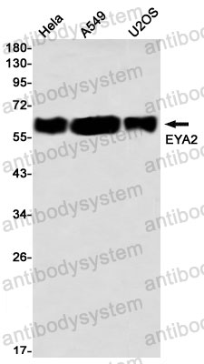 Anti-EYA2 Antibody (R1C66)