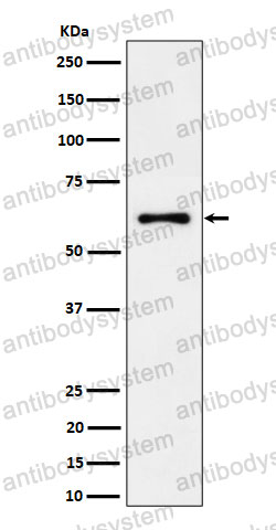 Anti-EYA2 Antibody (R1C65)
