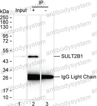Anti-SULT2B1 Antibody (R2T24)