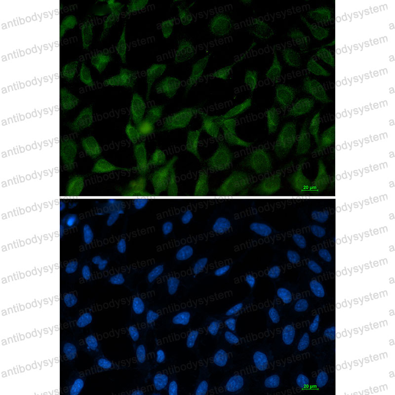 Anti-APBB1 Antibody (R1C68)