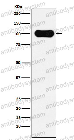Anti-APBB1 Antibody (R1C67)
