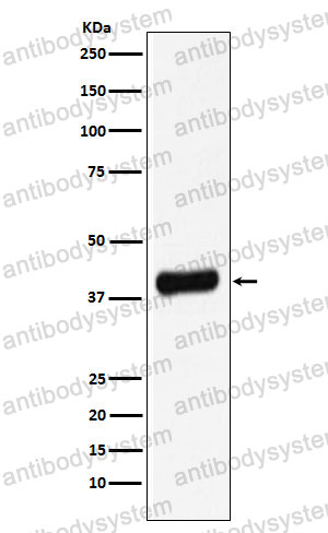 Anti-Galectin-8/GAL8 Antibody (R1C69)