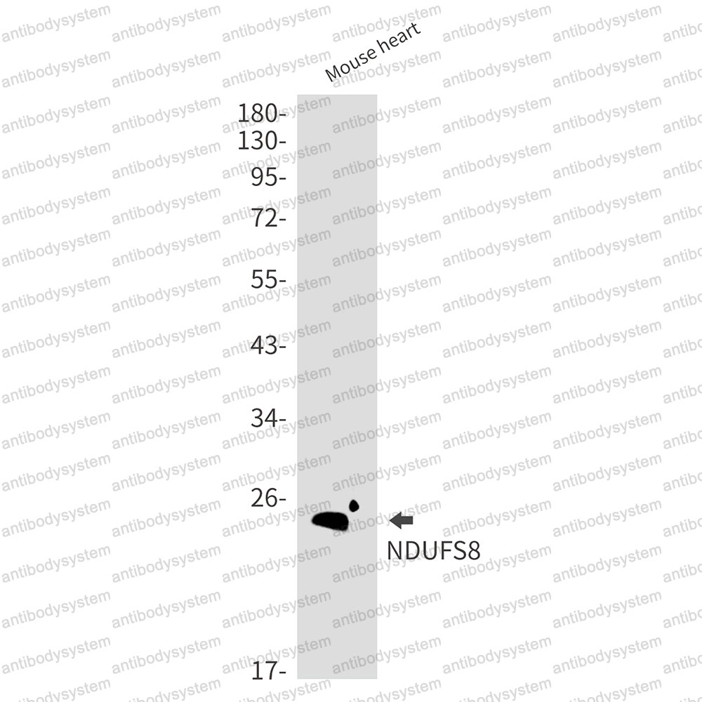 Anti-NDUFS8 Antibody (R1C70)