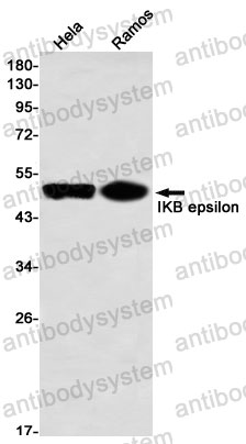 Anti-NFKBIE Antibody (R1C72)