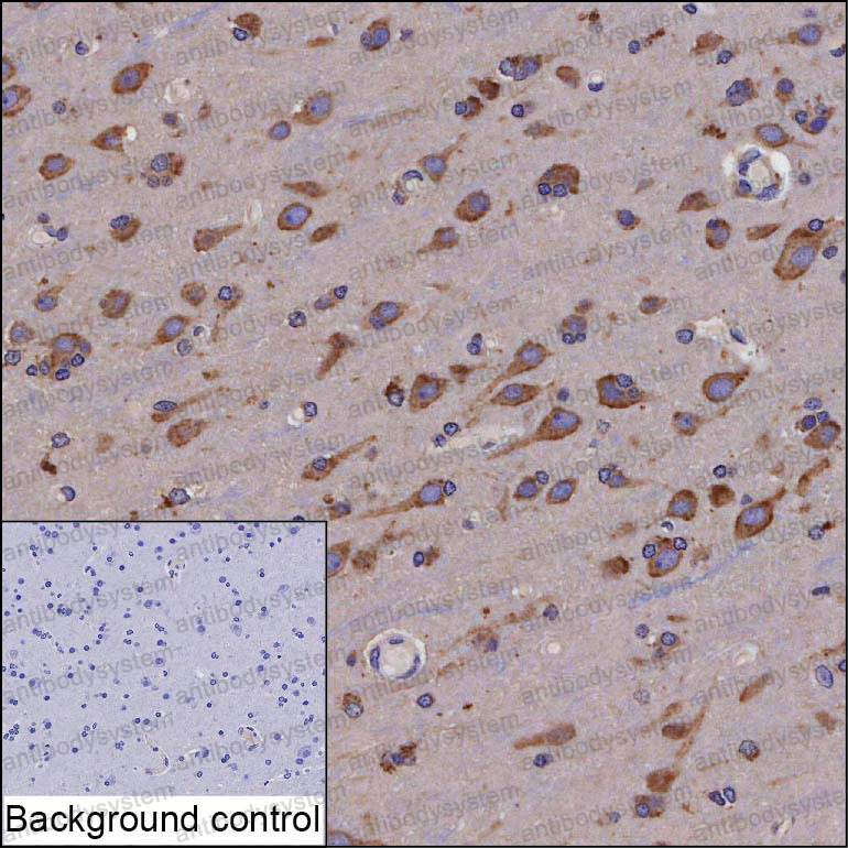 Anti-CDw293/BMPR1B Antibody (R2T28)