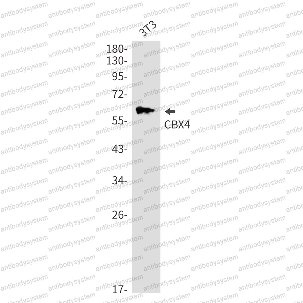 Anti-CBX4 Antibody (R1C75)