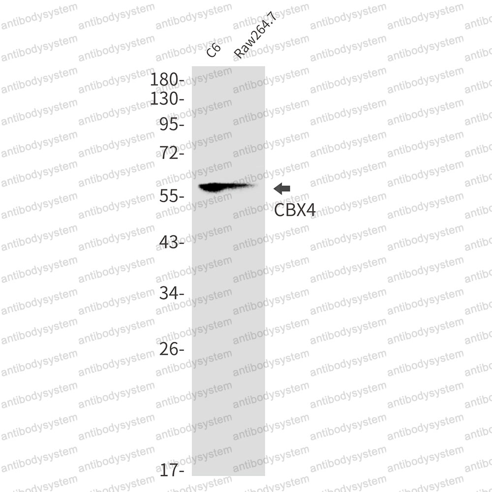 Anti-CBX4 Antibody (R1C74)