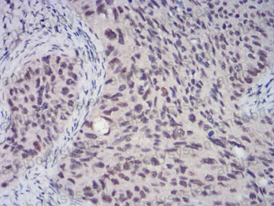 Immunohistochemical for Anti-CBX4 Antibody (R2T32) ?>