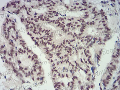 Immunohistochemical for Anti-CBX4 Antibody (R2T32) ?>