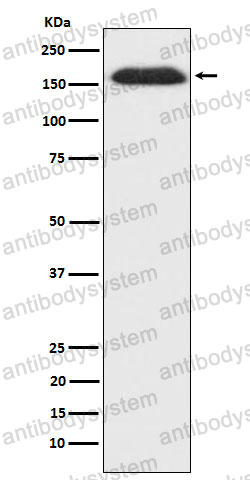 Anti-SUPT5H Antibody (R1C76)