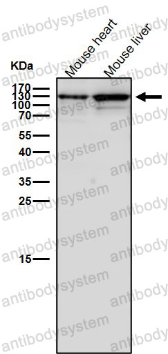 Anti-HIP1 Antibody (R1A59)